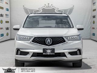 2017 Acura MDX
