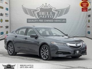 2017 Acura TLX