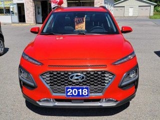 2018 Hyundai Kona