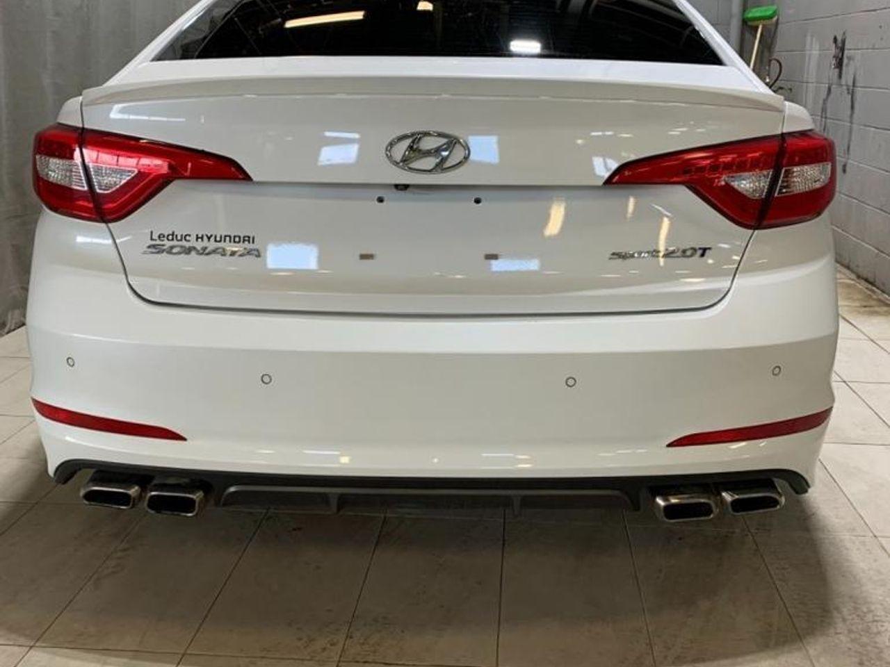 2015 Hyundai Sonata -3