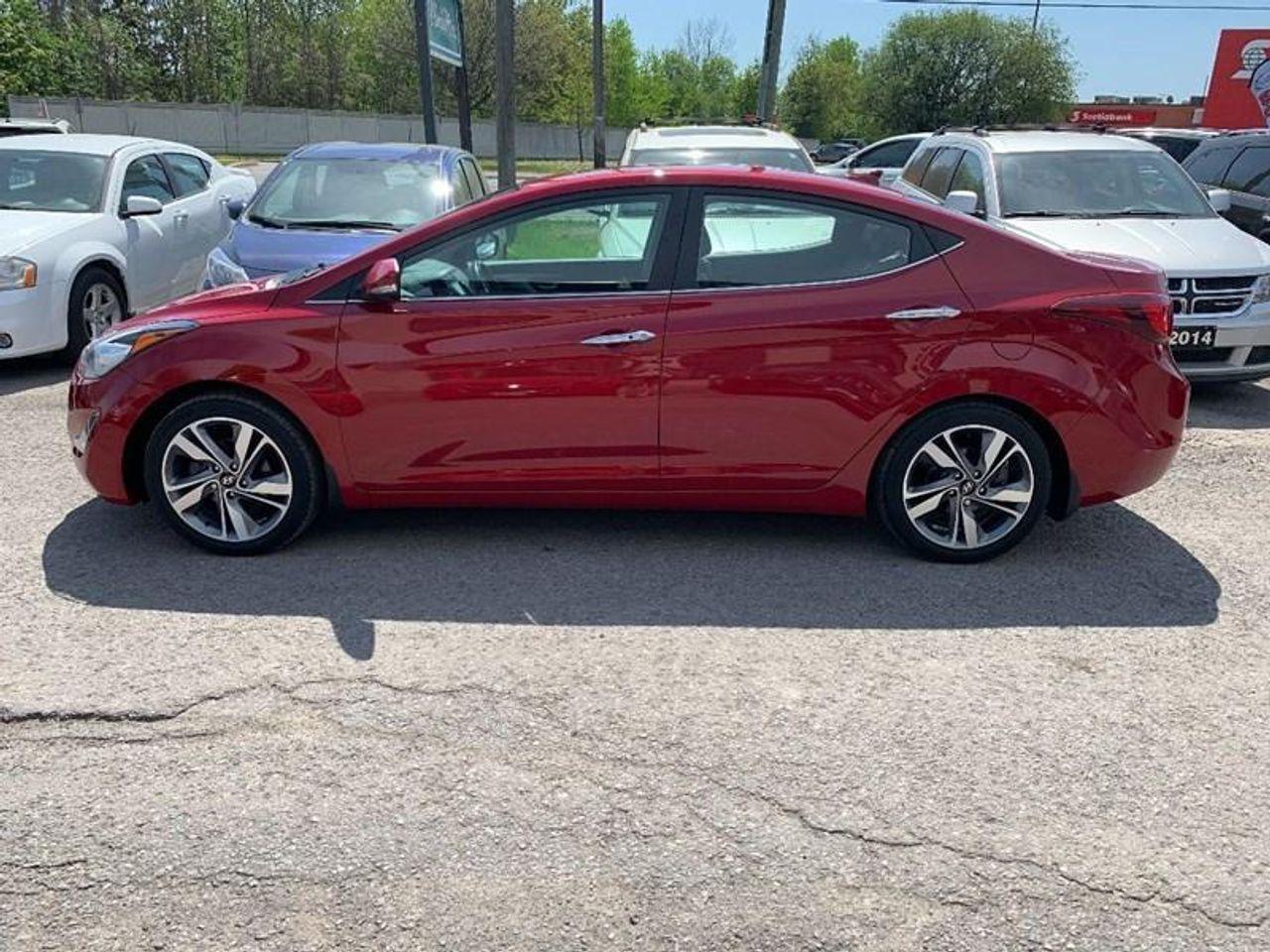 2016 Hyundai Elantra Sport-1