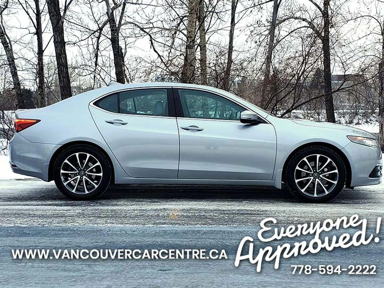 2017 Acura TLX -3