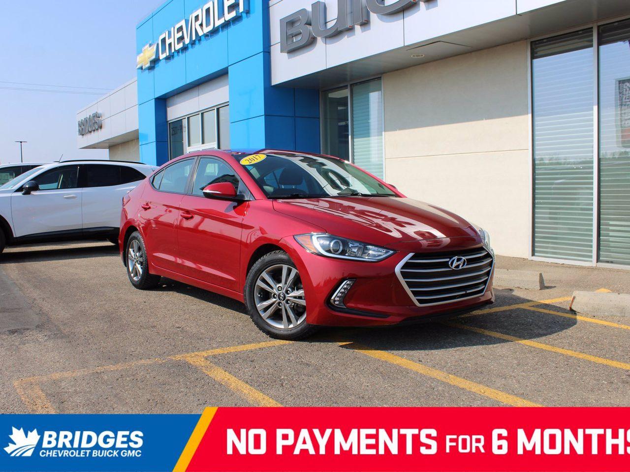 2017 Hyundai Elantra -0