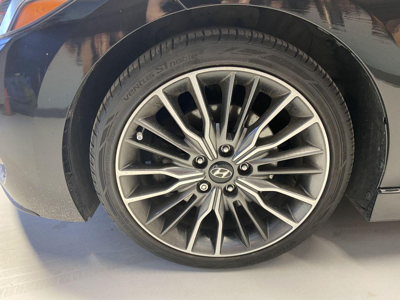 2017 Hyundai Elantra Sport-3