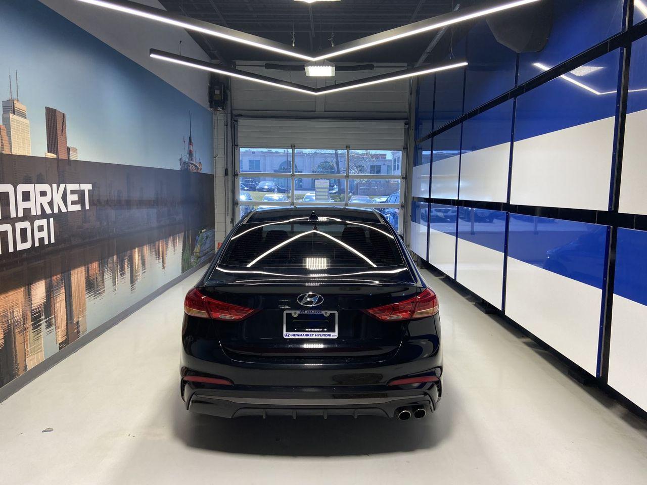 2017 Hyundai Elantra Sport-4