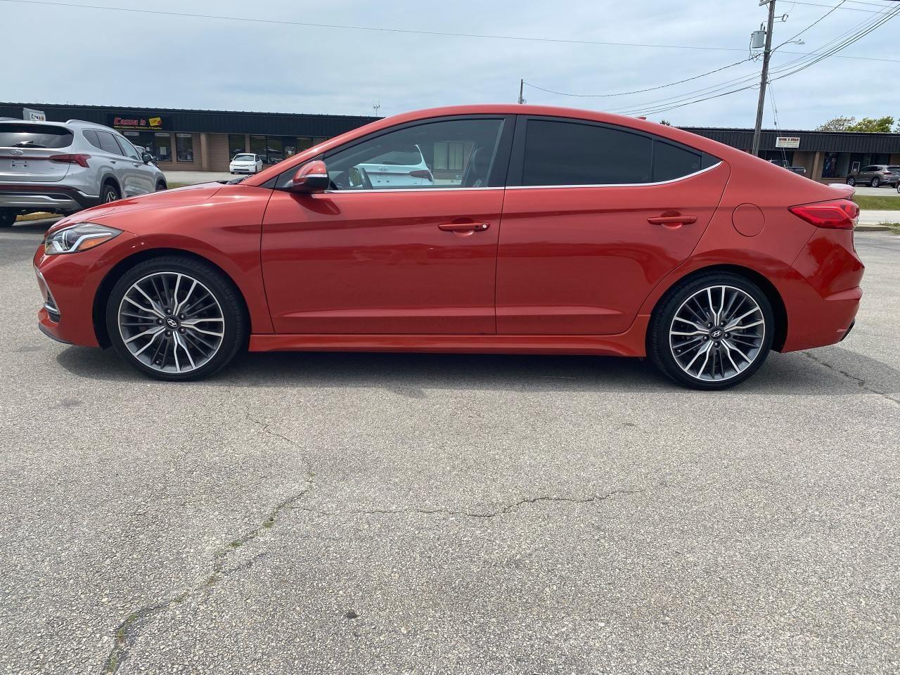 2017 Hyundai Elantra Sport-3