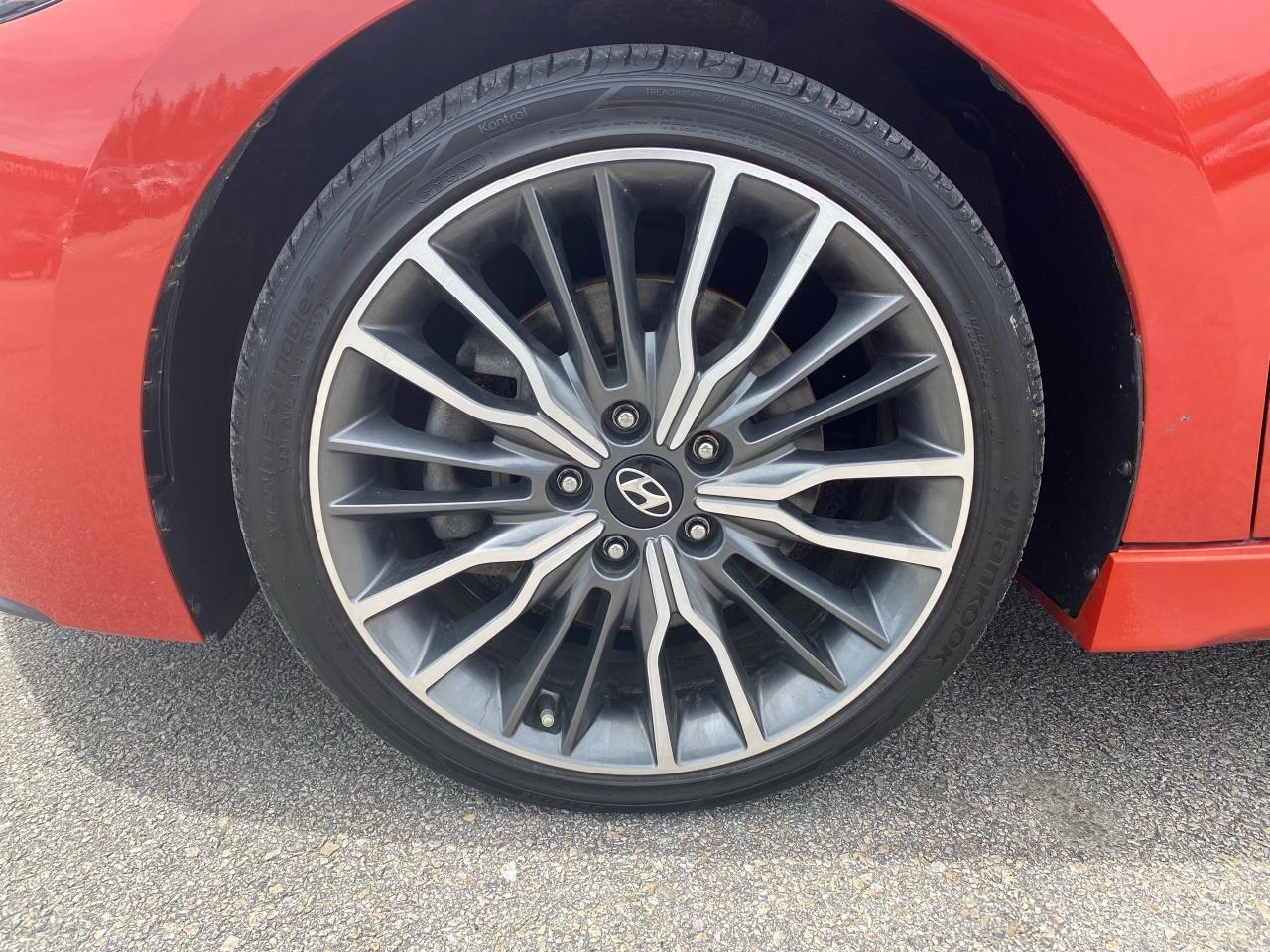 2017 Hyundai Elantra Sport-4