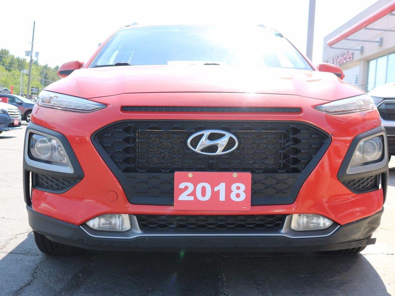 2018 Hyundai Kona Preferred-3