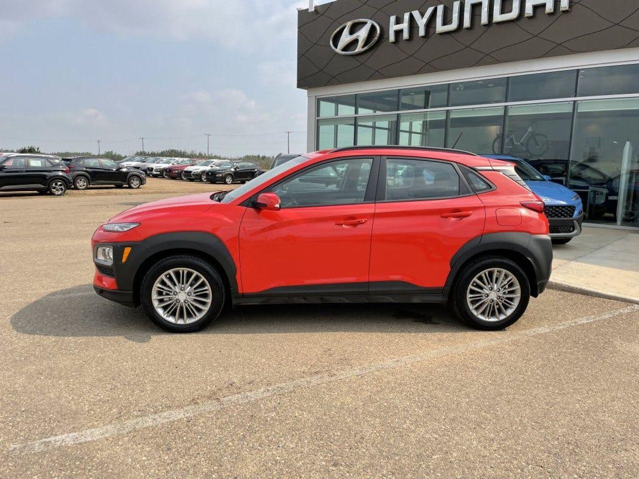 2018 Hyundai Kona Preferred-3
