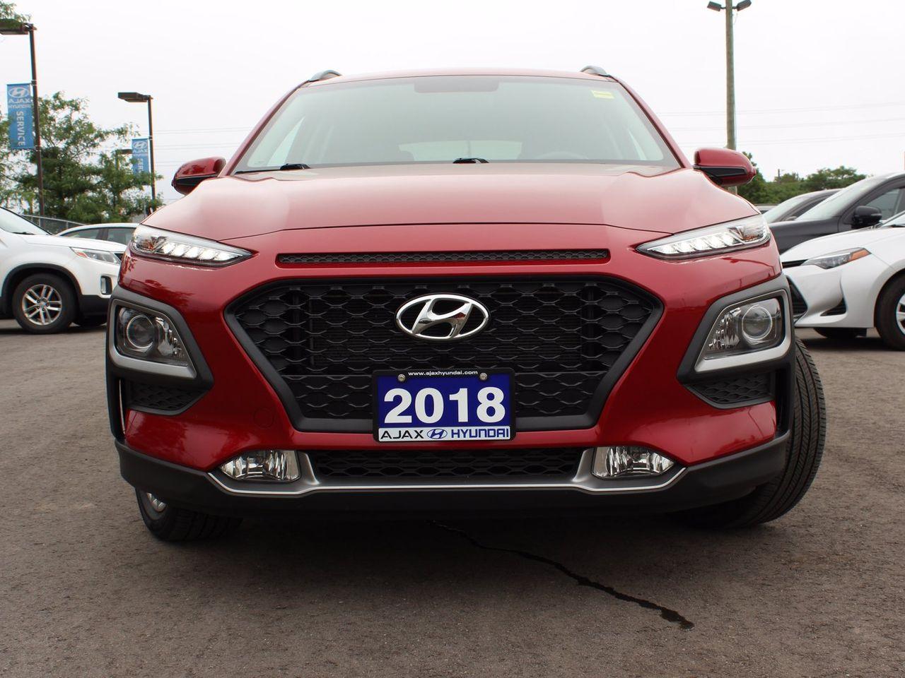 2018 Hyundai Kona Preferred-2
