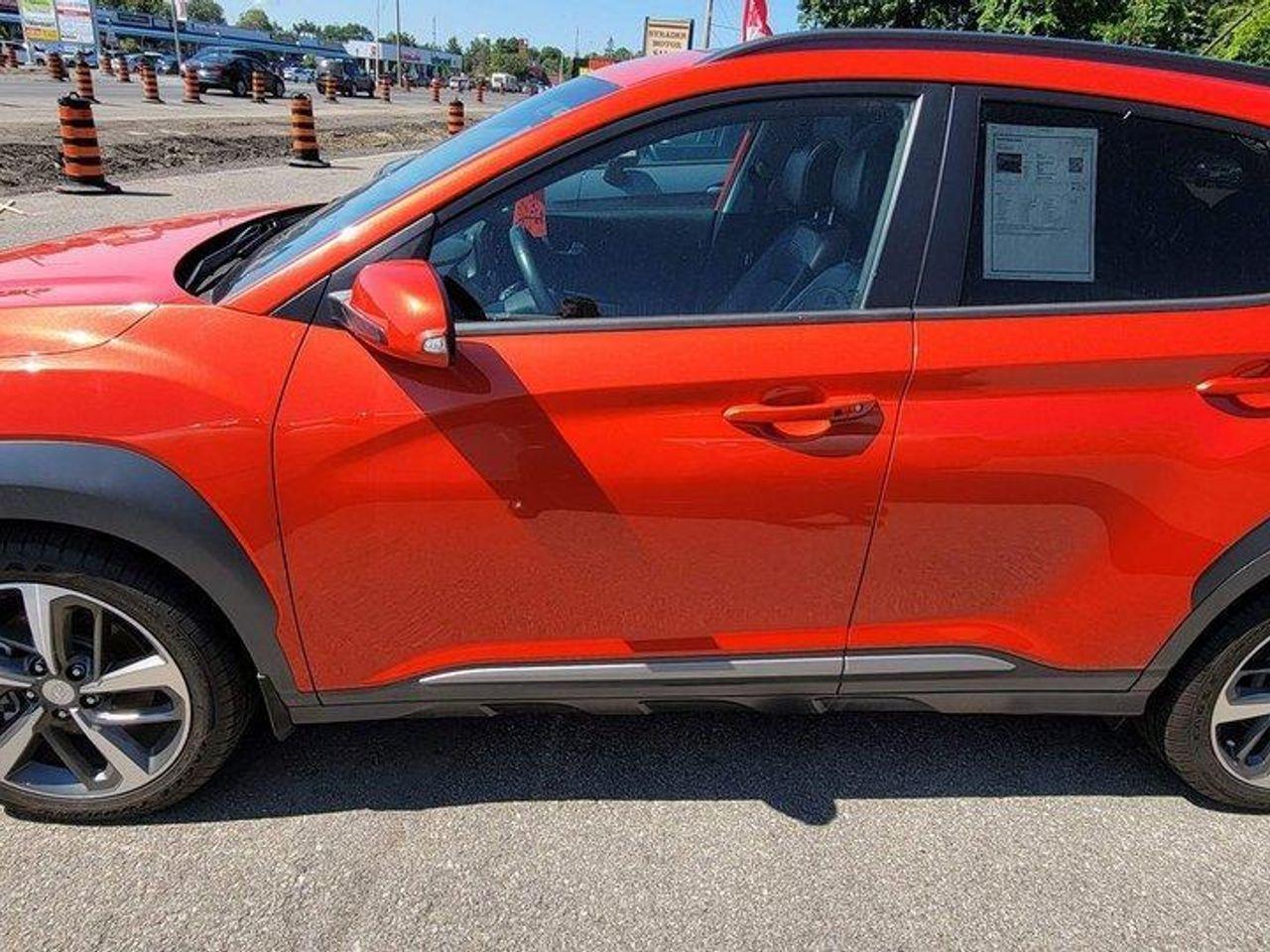 2018 Hyundai Kona ULTIMATE-2