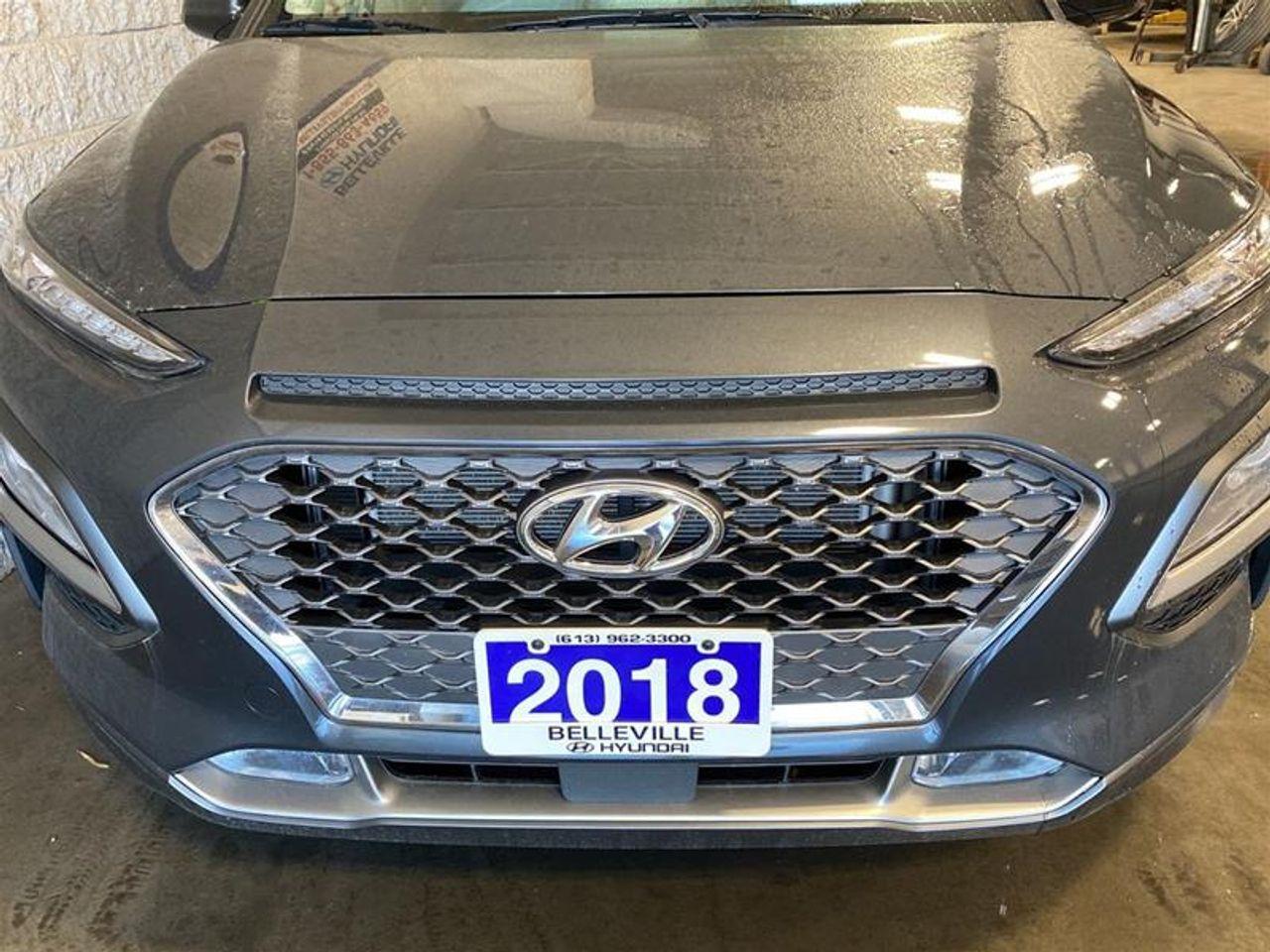 2018 Hyundai Kona ULTIMATE-3