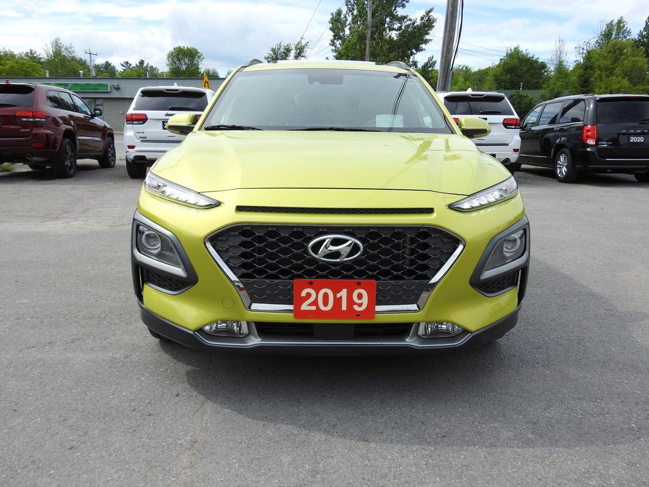 2019 Hyundai Kona Ultimate-3