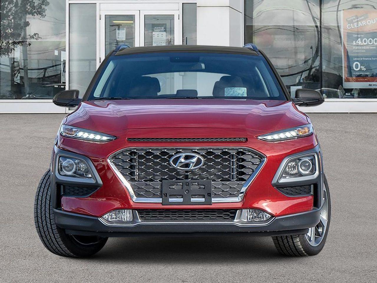 2021 Hyundai Kona -1