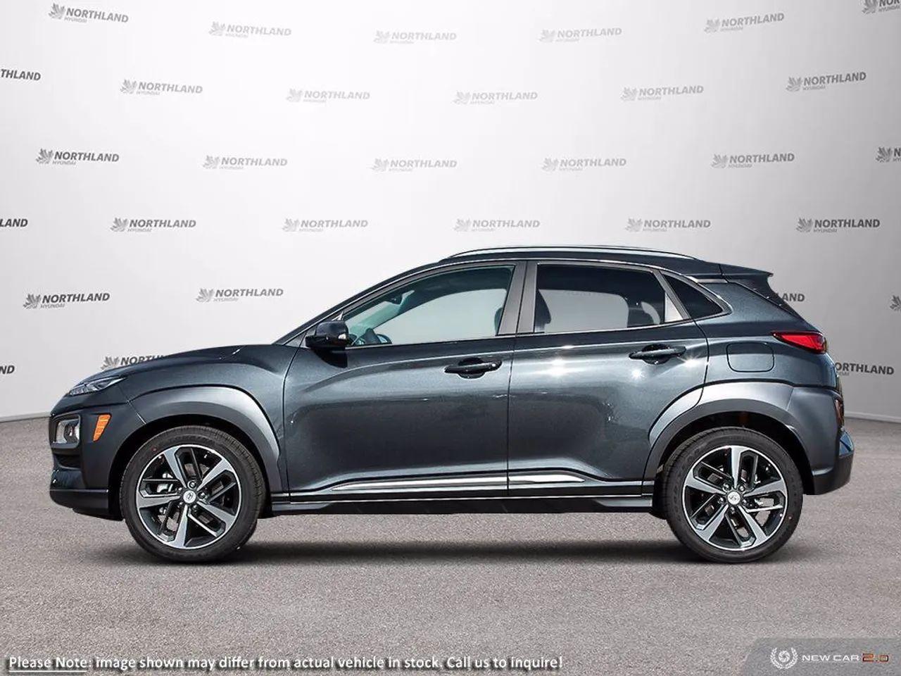2021 Hyundai Kona Ultimate-2