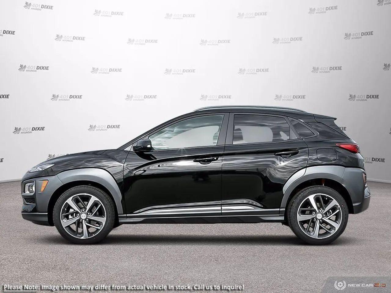 2021 Hyundai Kona Ultimate-2