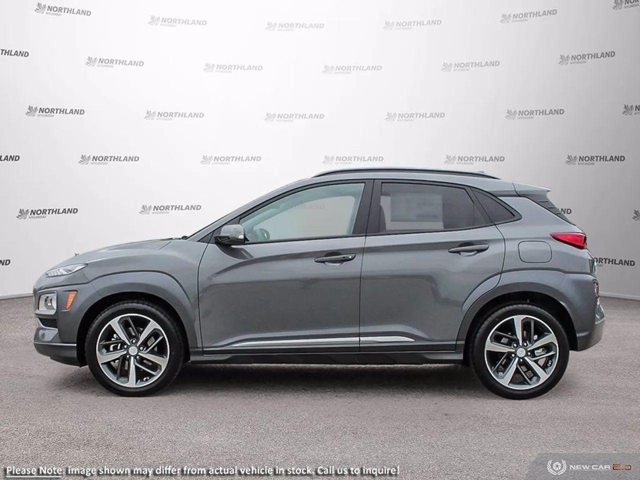 2021 Hyundai Kona Ultimate-2