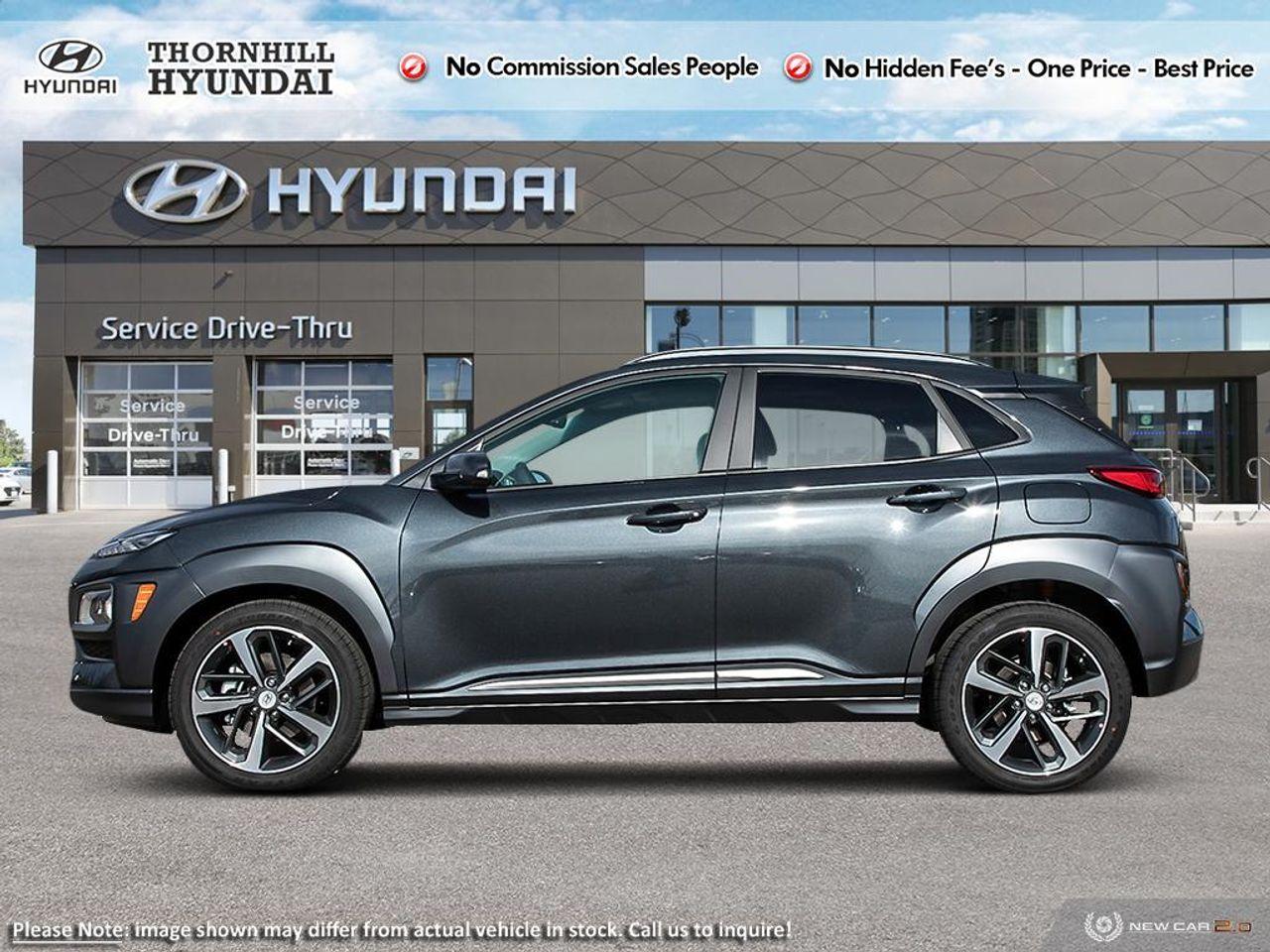 2021 Hyundai Kona ULTIMATE-2